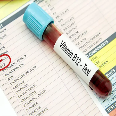 Personalized vitamin B12 treatment plan designed around individual health needs, deficiency levels, and lifestyle